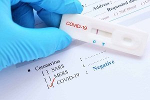 Fake covid-19 test results